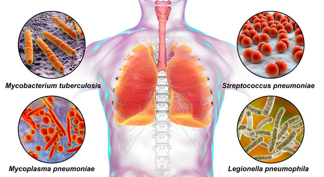 Mycoplasma pneumoniae