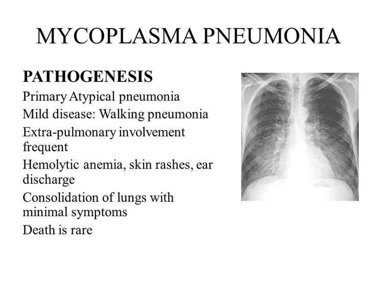 Mycoplasma pneumoniae