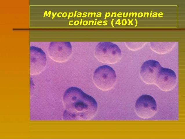 Mycoplasma pneumoniae