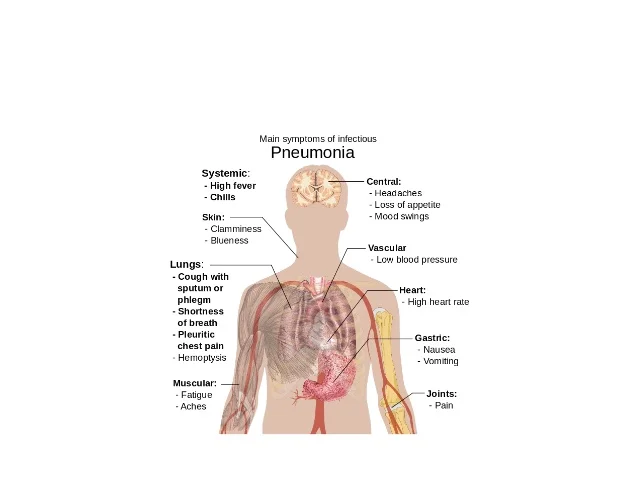 Mycoplasma pneumoniae